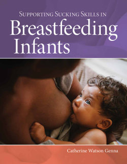 Supporting Sucking Skills In Breastfeeding Infants Supporting Sucking Skills In Breastfeeding Infants