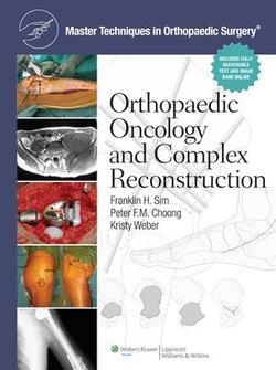 Master Techniques in Orthopaedic Surgery: Orthopaedic Oncology and Complex Reconstruction Master Techniques in Orthopaedic Surgery: Orthopaedic Oncology and Complex Reconstruction