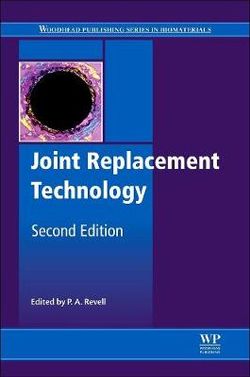 Joint Replacement Technology Joint Replacement Technology