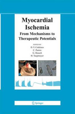 Myocardial Ischemia Myocardial Ischemia