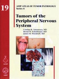 Tumors of the Peripheral Nervous System Tumors of the Peripheral Nervous System