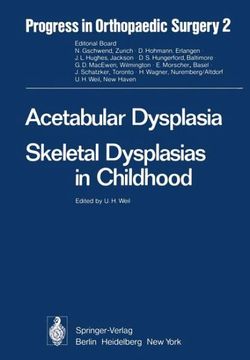 Acetabular Dysplasia Acetabular Dysplasia