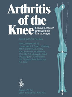 Arthritis of the Knee Arthritis of the Knee