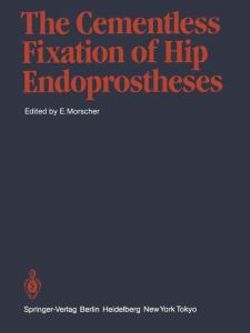 The Cementless Fixation of Hip Endoprostheses The Cementless Fixation of Hip Endoprostheses