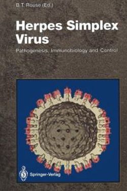 Herpes Simplex Virus Herpes Simplex Virus